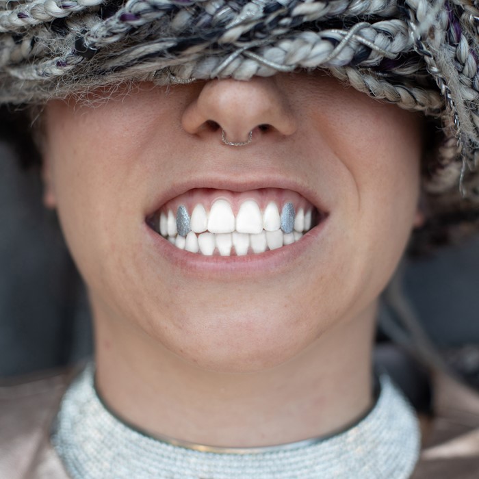 Dental fashion trends: are they harmful to your health? dental fashion trends