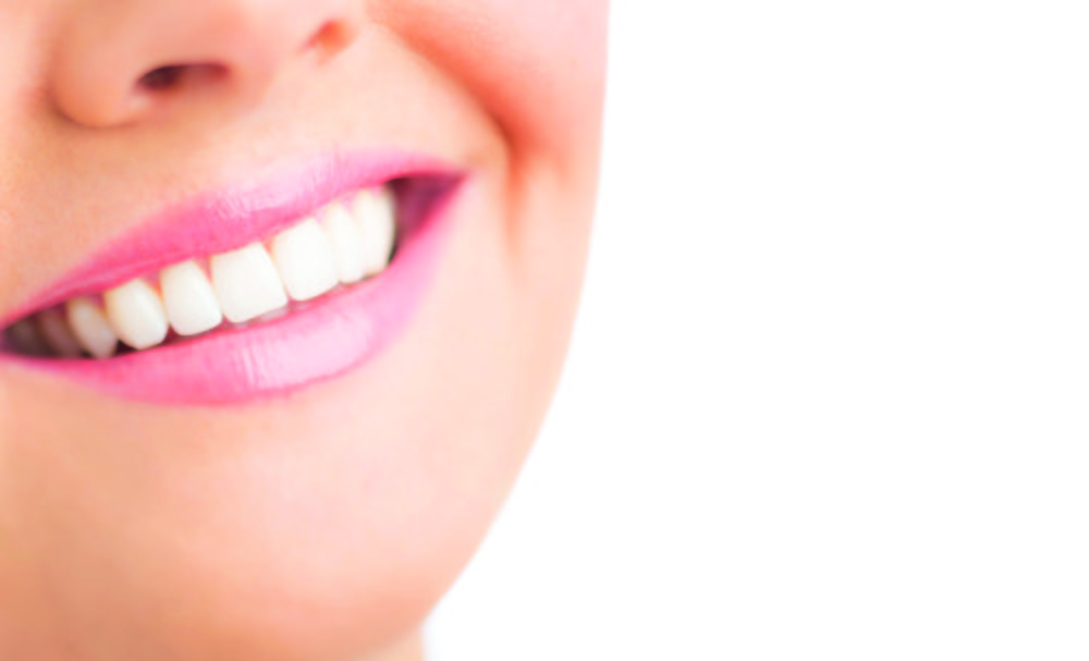 My smile: time for a makeover My smile: time for a makeover