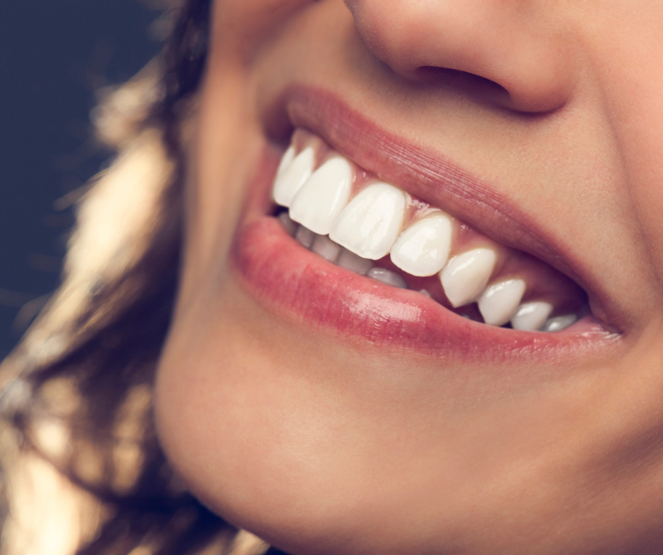 Northumberland Dental Care_Teeth Bonding