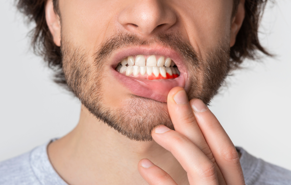 Northumberland Dental Care_receding gums