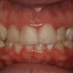 cg00010
