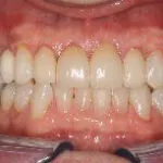 dm0022