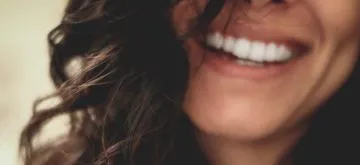 Teeth whitening