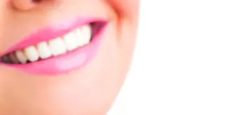 My smile: time for a makeover