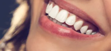 Northumberland Dental Care_Teeth Bonding