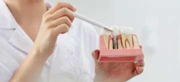 Northumberland Dental Care_Dental Implants
