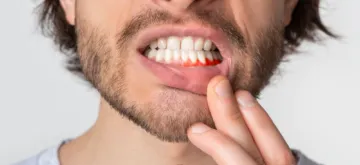 Northumberland Dental Care_receding gums