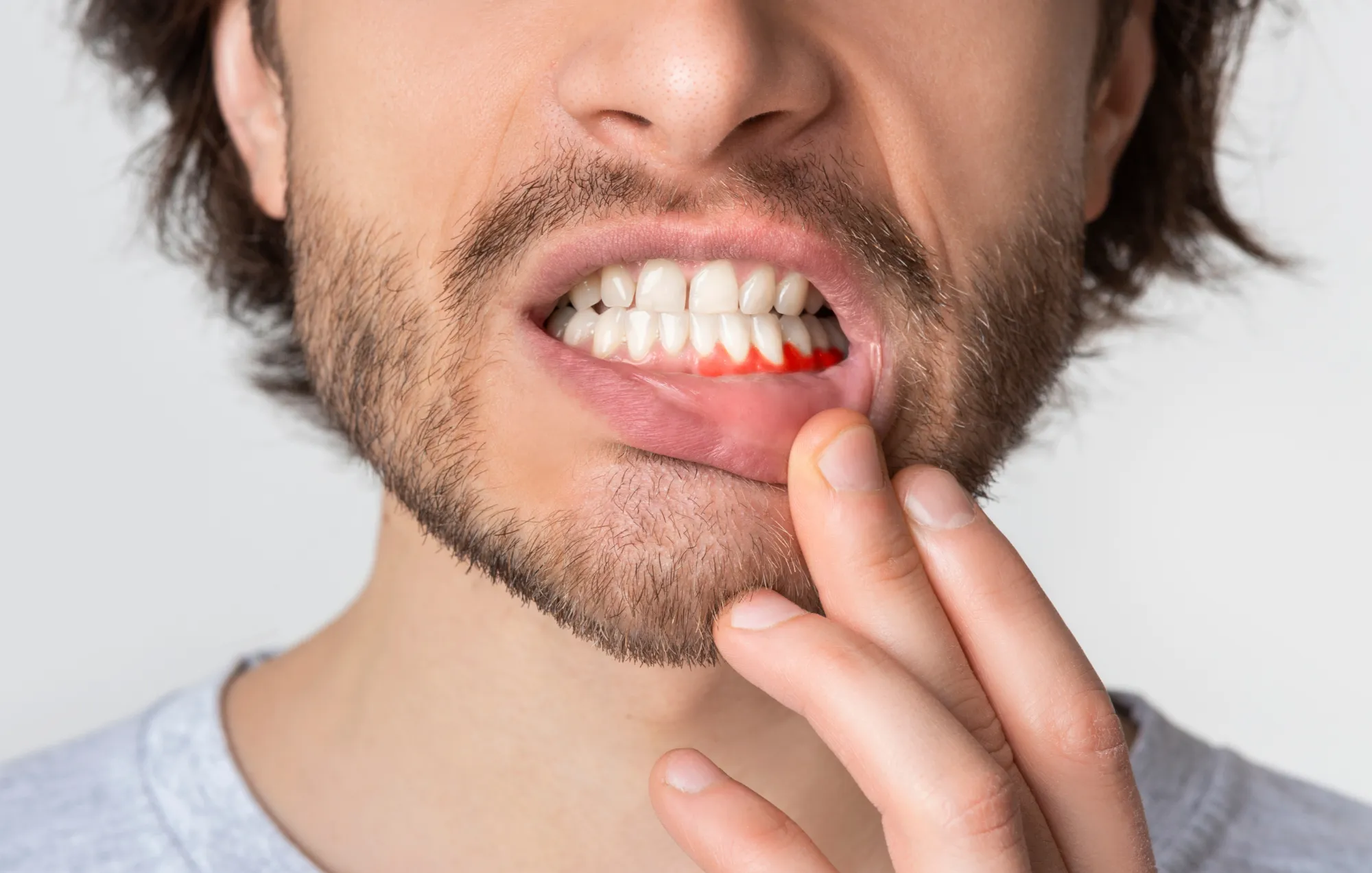 Northumberland Dental Care_receding gums