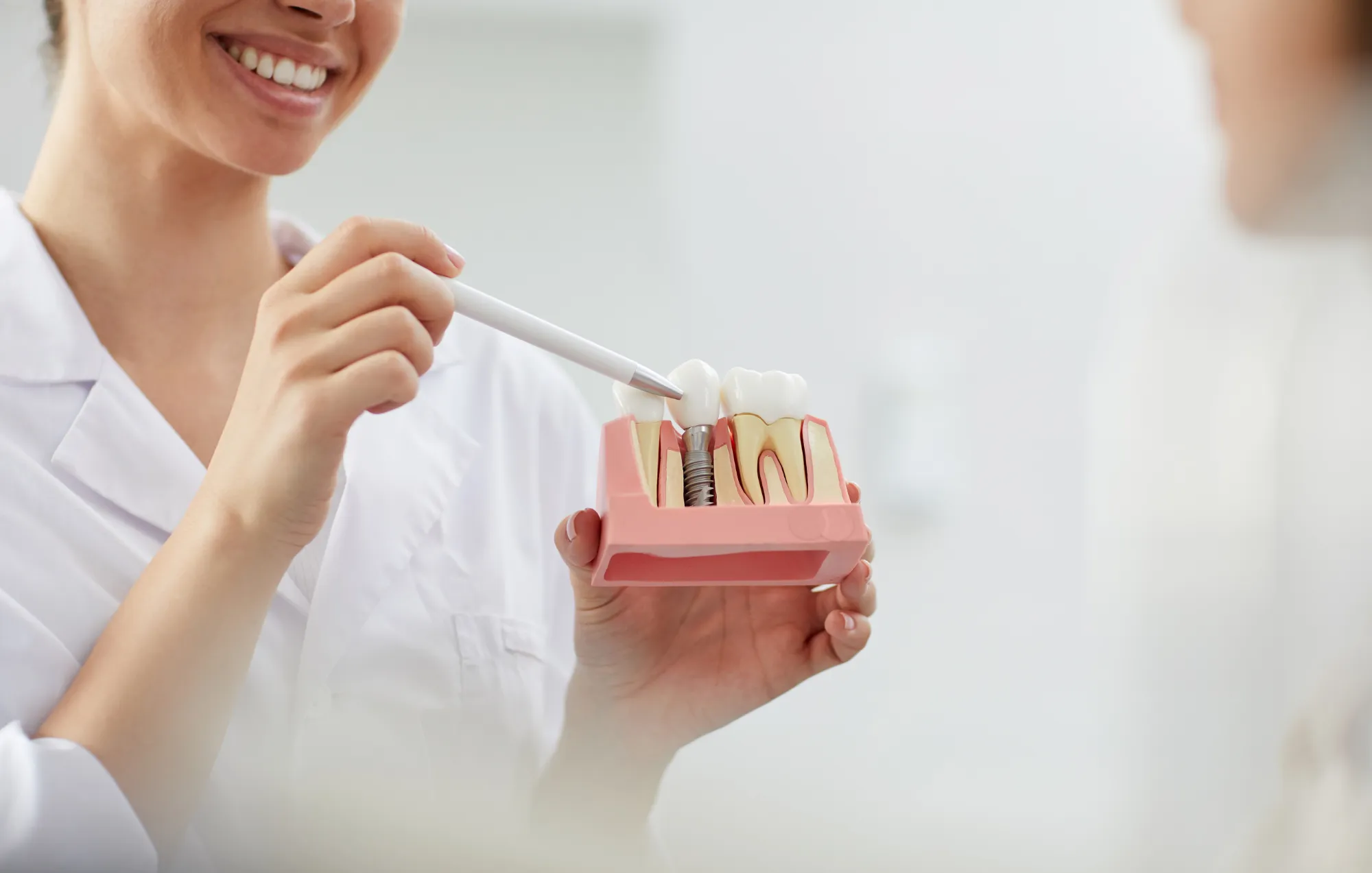 dental implants