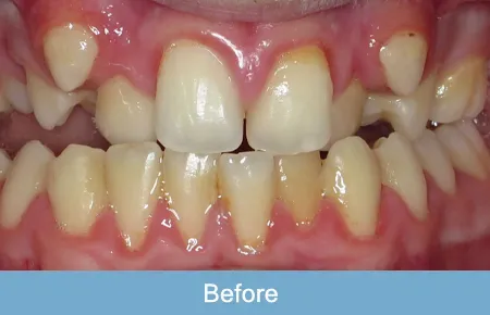 Orthodontics, Before 1