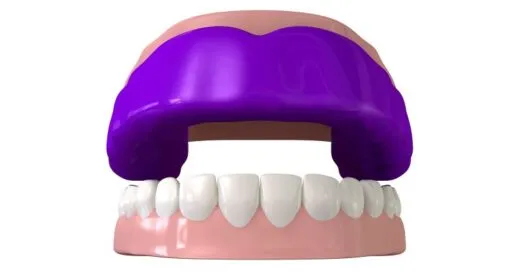 Mouth Guards are vital as the school and college term kicks off, there is no better time to invest in a protective mouth guard. Book your appointment today!