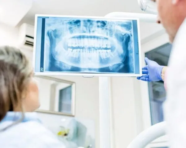 Dental X-Rays