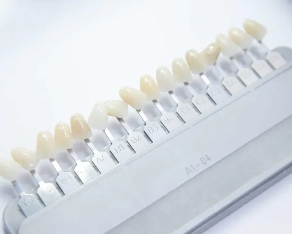 Dental Veneers, Dental Care Ireland