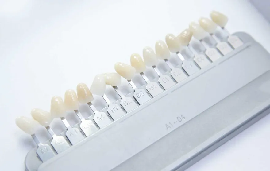 Dental Veneers, Dental Care Ireland