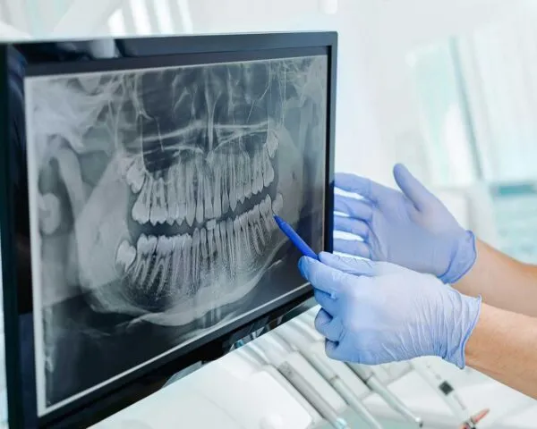 Oral Surgery at Dental Care Ireland. Oral surgery is an area of dentistry that specialises in conditions of the mouth or jaw.