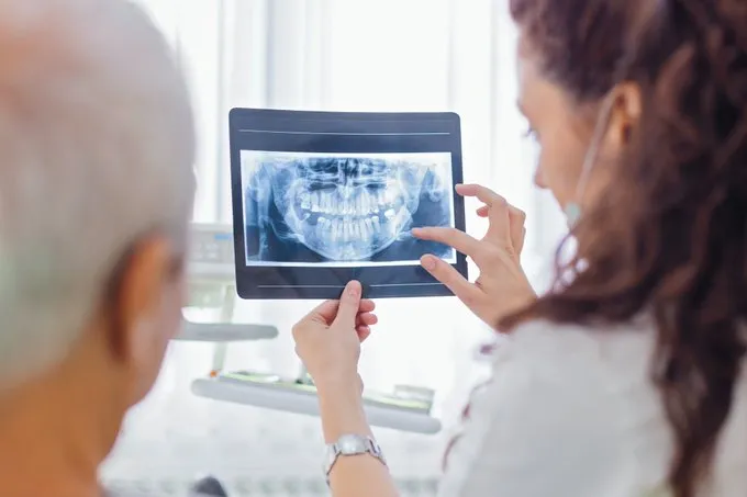 Having missing teeth can be a very common occurence, but it is worth getting treatment to ensure there are no serious consequences