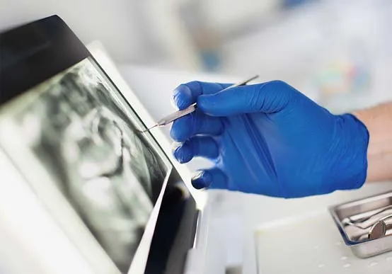 People with diabetes need to take good care of their oral health as they can be susceptible to various problems if their condition is not managed properly
