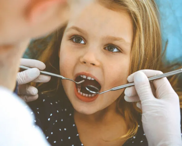 dental care ireland how to spot childrens tooth decay