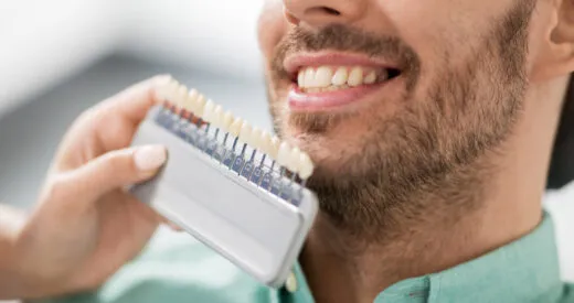 Dental Care Ireland Teeth Whitening FAQs