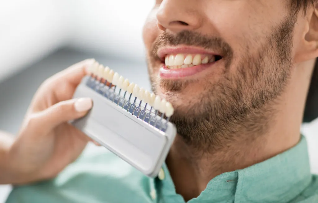 Dental Care Ireland Teeth Whitening FAQs