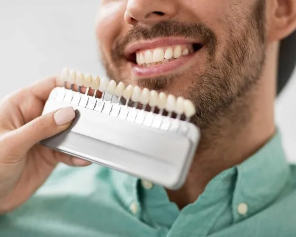 Composite Bonding at Dental Care Ireland