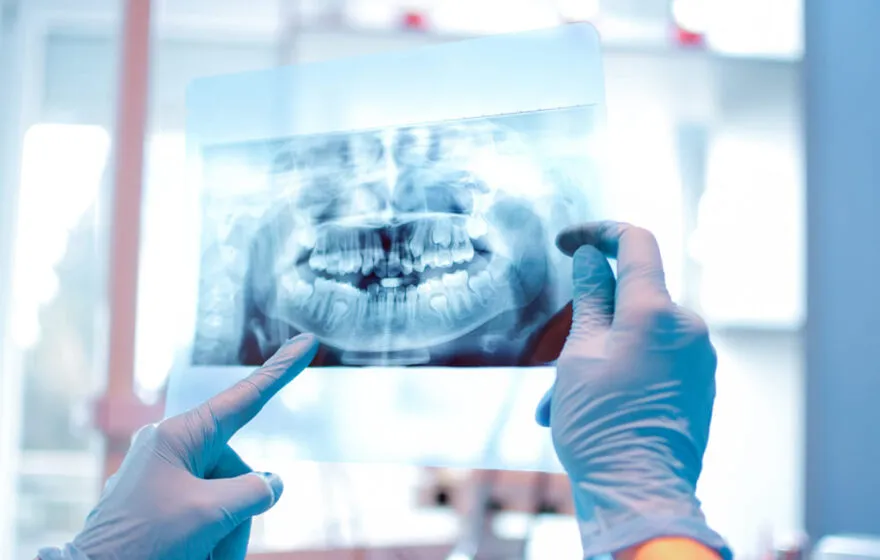 Dental Care Ireland Xrays