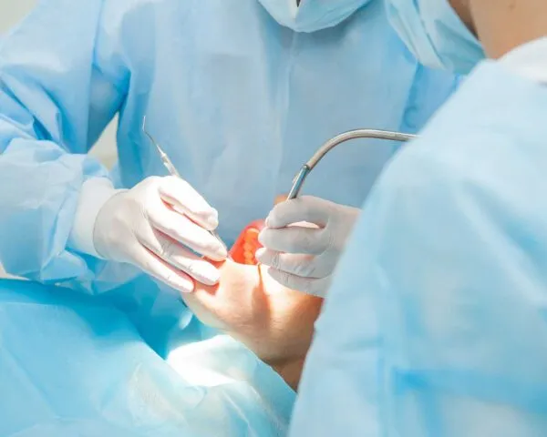 Oral Surgery at Dental Care Ireland