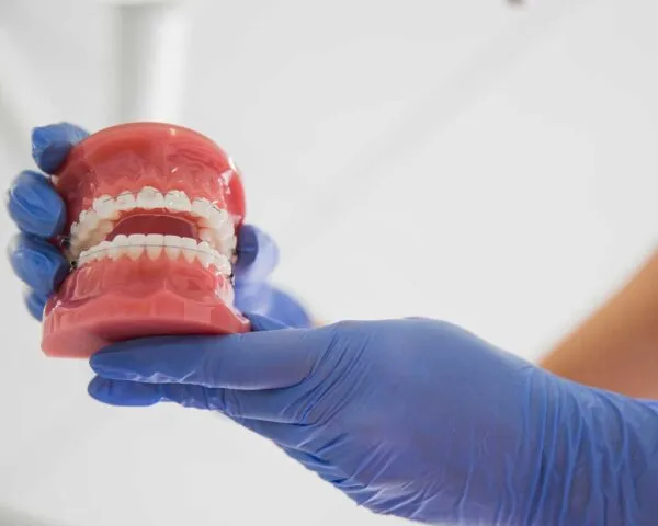 Clear/Ceramic Children's Braces at Dental Care Ireland Cabinteely