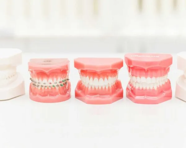 Orthodontics at Dental Care Ireland. Orthodontics is the branch of dentistry concerned with the correction of misaligned teeth. Visit our website and book an appointment online today.