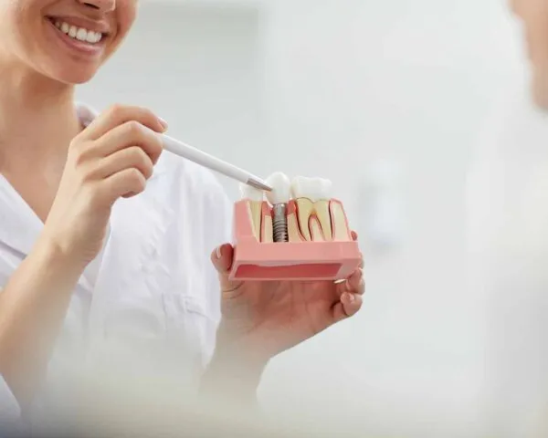 Dental Implants at Dental Care Ireland