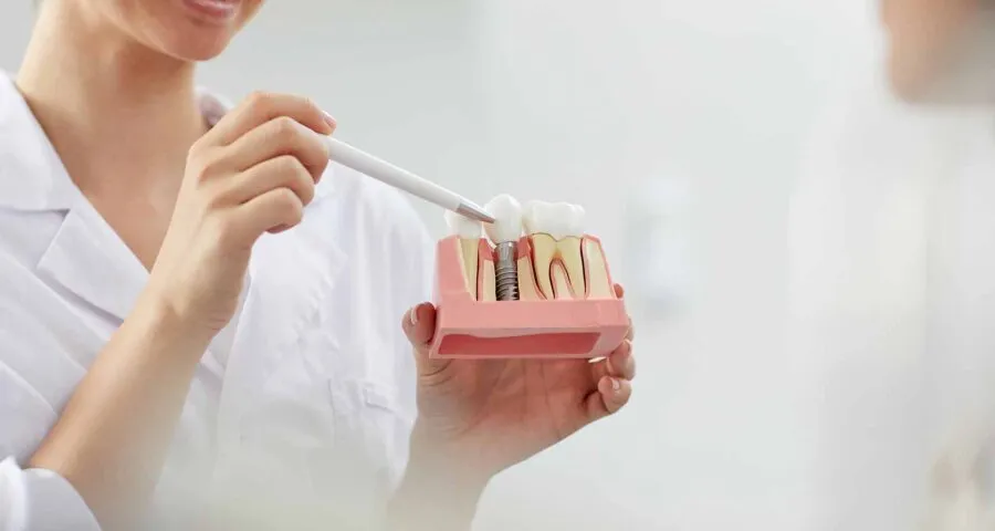 Dental Implants at Dental Care Ireland