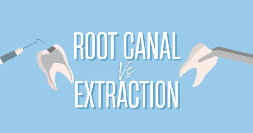 Root Canal vs Tooth Extraction