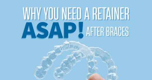 Why You Need a Retainer ASAP After Braces